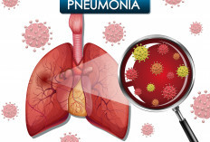 Mengenal Tentang Pneumonia yang Sebabkan Paus Fransiskus Meninggal Dunia