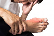 Tips Ampuh Meredakan Asam Urat pada Kaki, Hidrasi dan Kompres Dingin Jadi Solusi Utama!